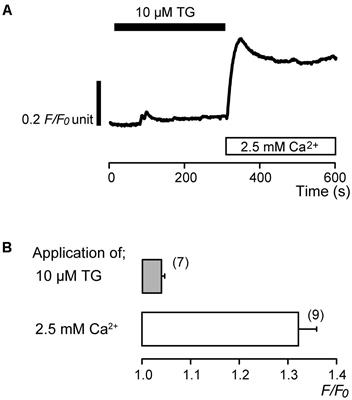 High pH-Sensitive Store-Operated Ca2+ Entry Mediated by Ca2+ Release-Activated Ca2+ Channels in Rat Odontoblasts